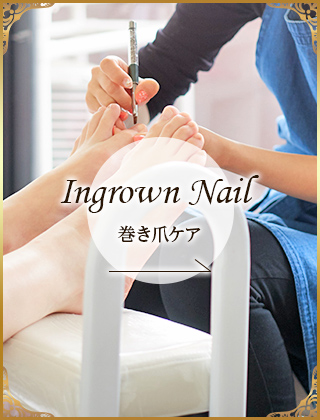 Ingrown Nail 巻き爪ケア