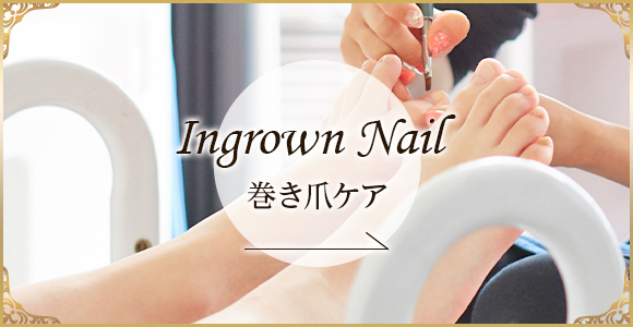 Ingrown Nail 巻き爪ケア